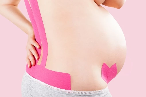 Kinesiotaping w ciąży i połogu